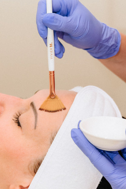 Vivier Chemical Peel