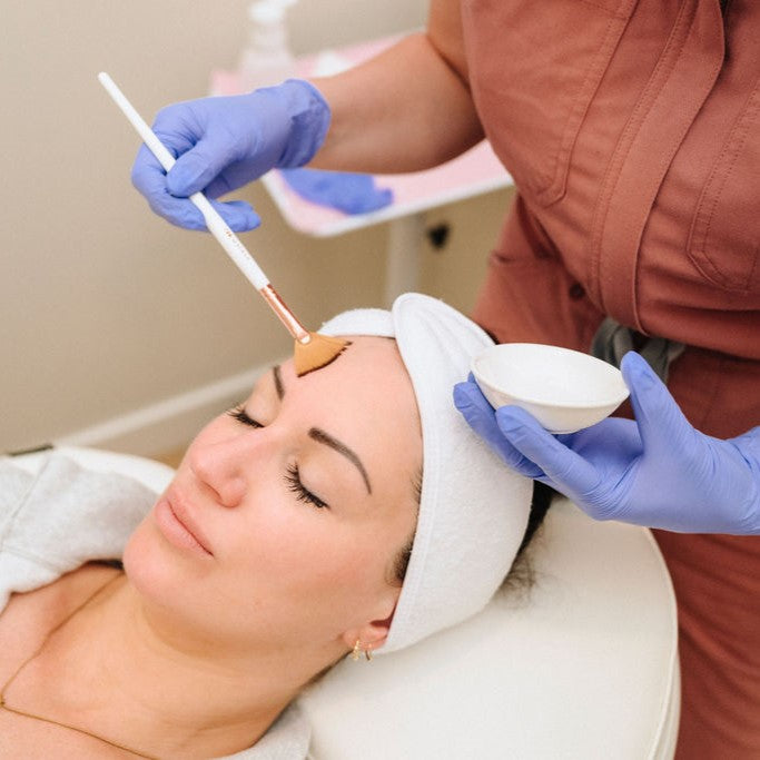 Chemical Peel Package